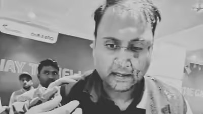 'Hope I get justice': Flyer thrashed by Air India Express pilot at Delhi airport suffers nasal fracture; FIR filed